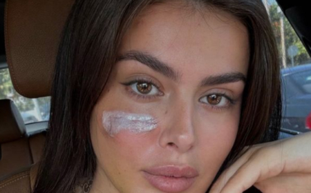 Incidenti me motrat Berisha – modelja shqiptare tregon gjendjen shëndetësore